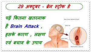 brain stroke in hindi